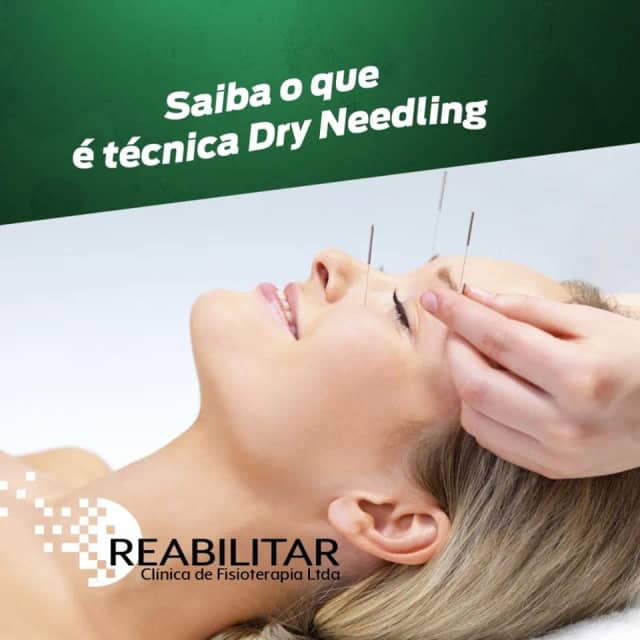 Foto 5 de Reabilitar Clínica de Fisioterapia, Fisioterapeutas em Divinópolis - MG