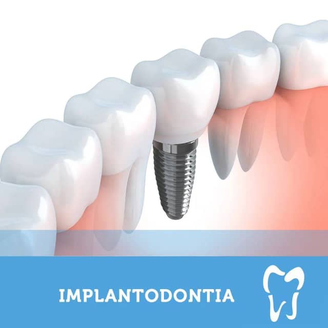 Foto 4 de Eliodonto, Dentistas em Divinópolis - MG