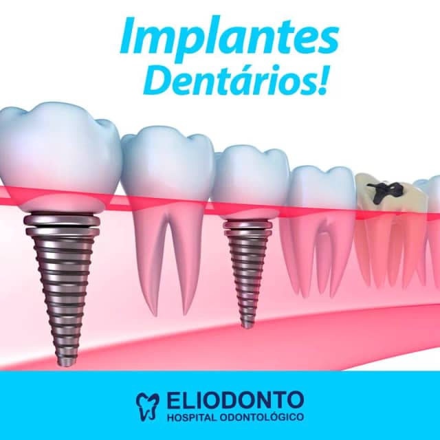 Foto 3 de Eliodonto, Dentistas em Divinópolis - MG